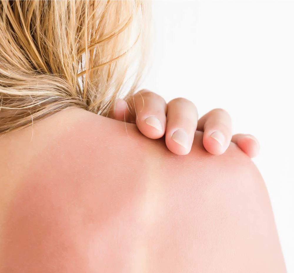 Ahhhsome Relief® by FarmHouse Fresh skincare - Image 3