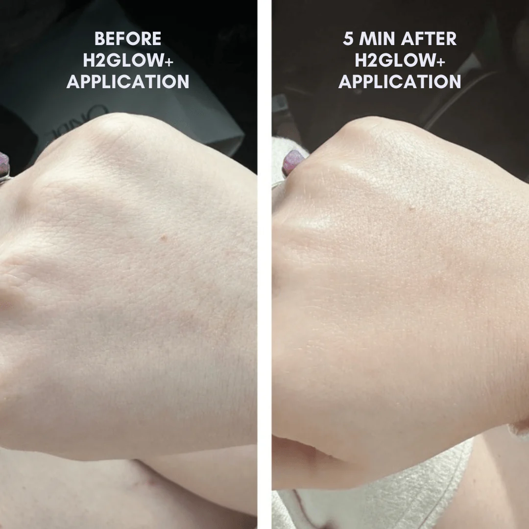 BUNDLE & SAVE! The Skin Reset Starter Kit - Image 3