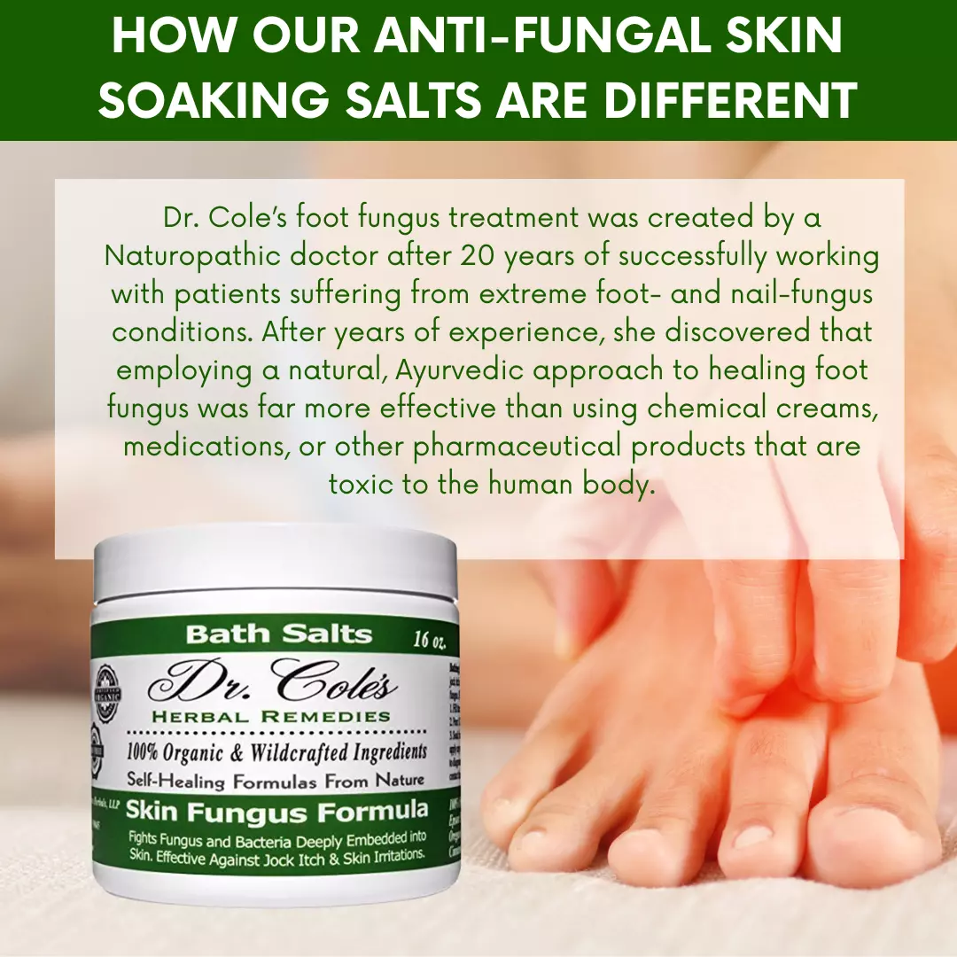 11 - Dr. Cole’s Organic Anti-fungal Skin Soaking Salts - Image 12