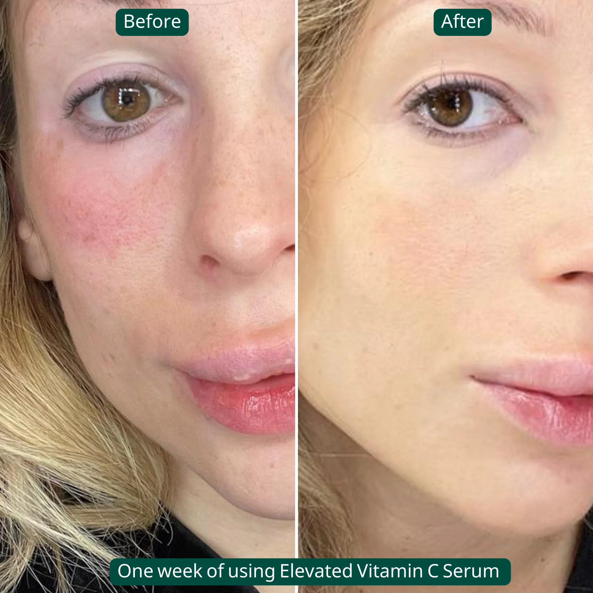 Elevated Vitamin C Serum - Tightens Skin & Brightens Skin - Image 3