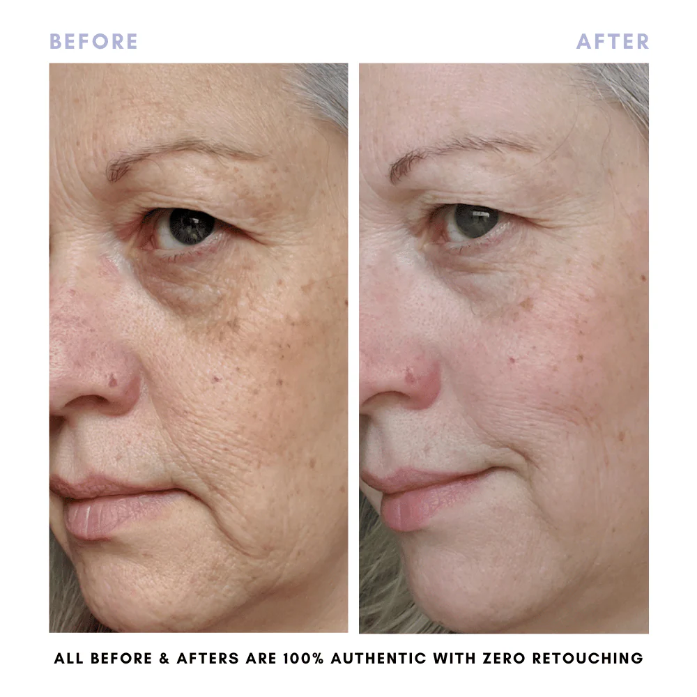 The Complete Complexion Set - Image 11