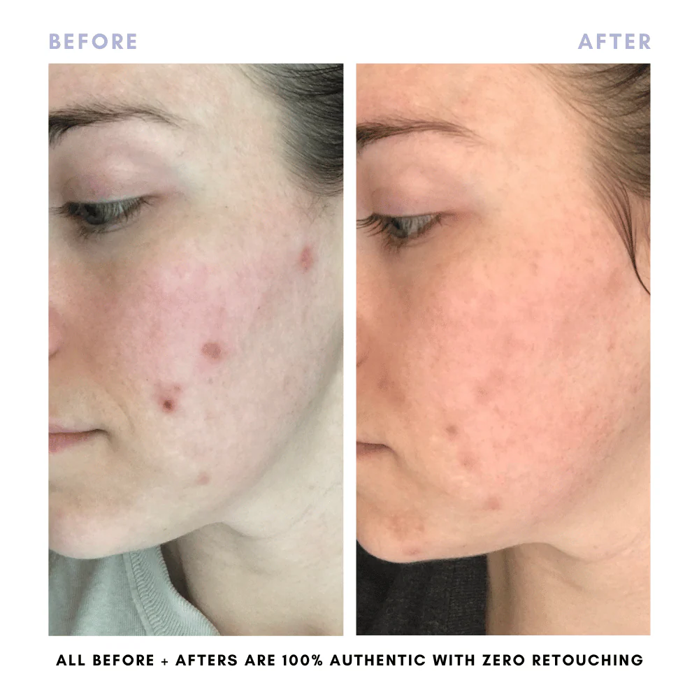 The Complete Skincare Collection - Image 13