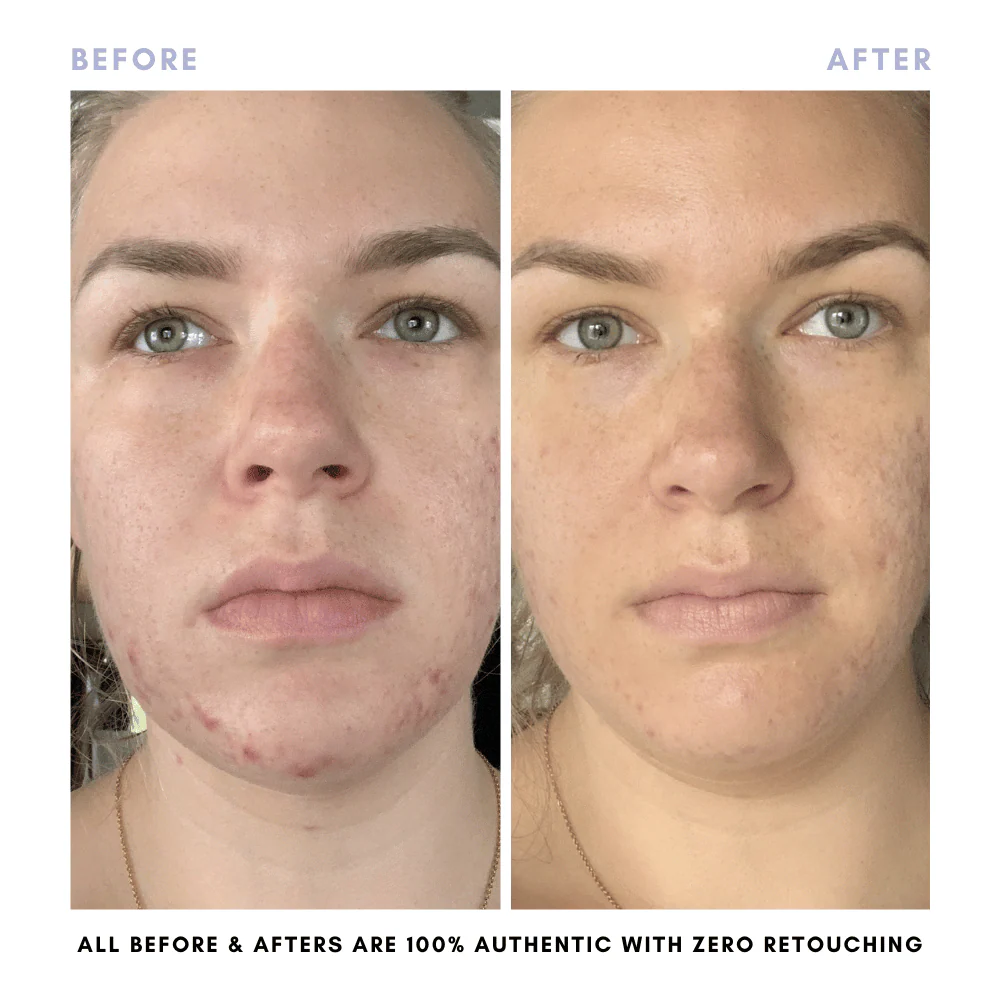 The Complete Skincare Collection - Image 15
