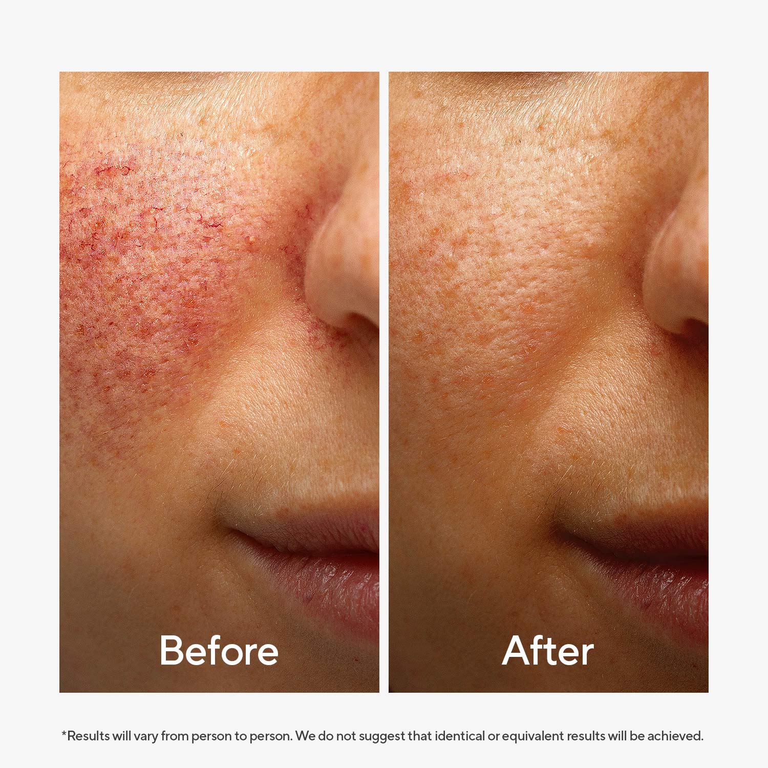 Ultra Hydrating Face Serum - Image 7